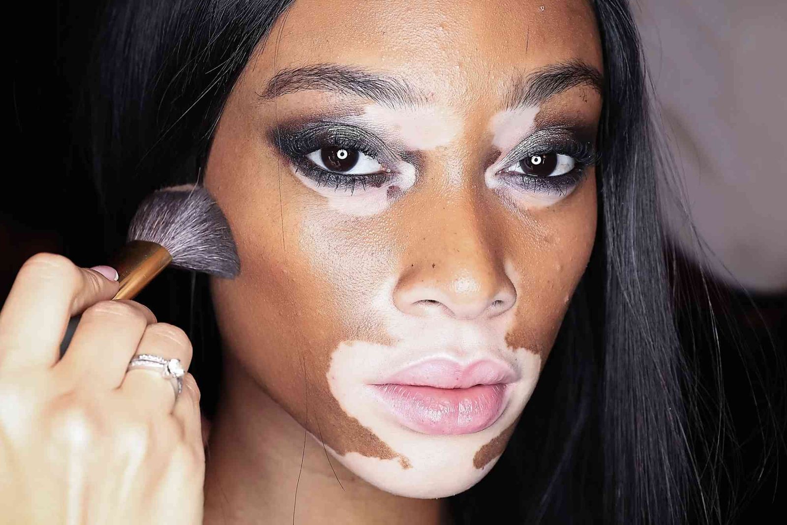 vitiligo makeup waterproof